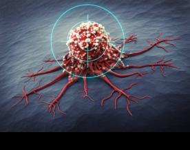 About 70 per cent of premature cancer deaths in 2020 preventable, 30 per cent treatable: Lancet study