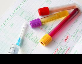 Liquid biopsies can identify any remaining illness after cervical chemoradiation: Study