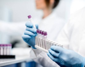 Indian Diagnostics Sector Poised for 14% Growth; Organised Players to Take the Lead