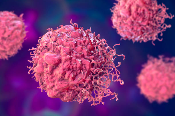 Researchers discover new approach against follicular lymphoma