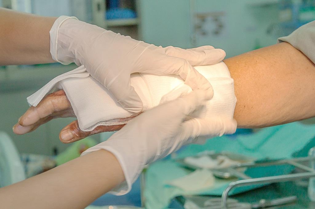 Programmable 3D printed wound dressing could improve treatment for burn, cancer patients: Study