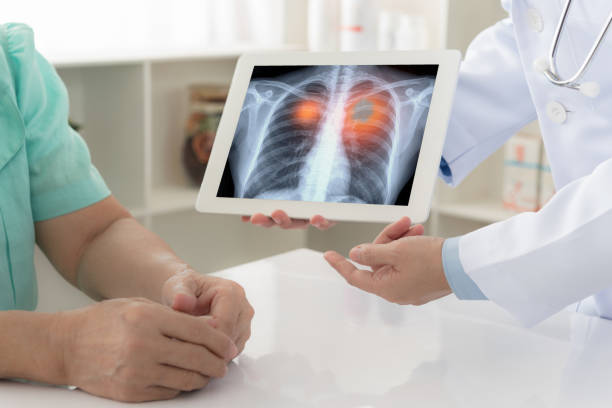 Anatomic lung resection linked to improved survival for early-stage lung cancer: Study