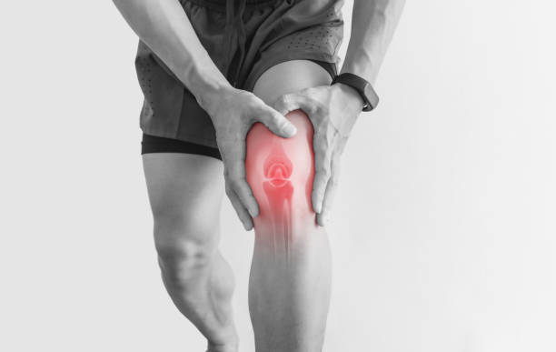 Having x-ray to diagnose knee arthritis might make you more likely to consider potentially unnecessary surgery
