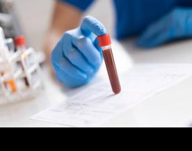 Kara-Kul residents face difficulty in hemoglobin testing 