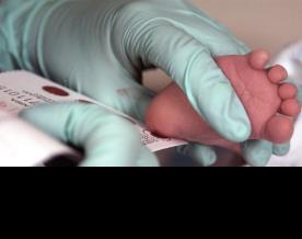 Expanded neonatal screening identifies 30 children with SMA