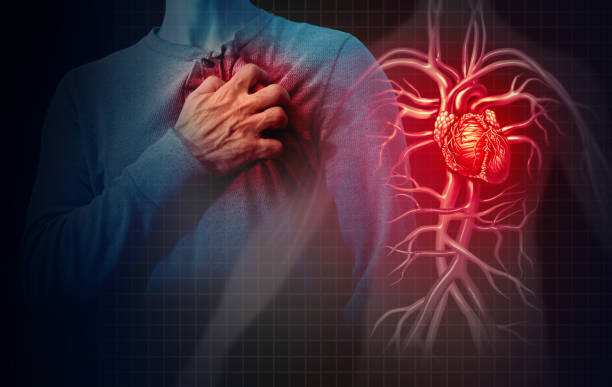 Scheme launched to prevent deaths due to heart attacks