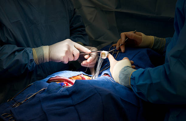 Technological advancement in cardiovascular surgery makes life easy for patients and doctors