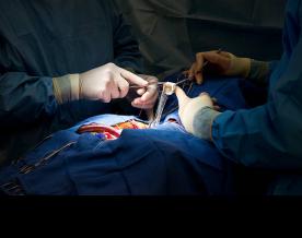 Technological advancement in cardiovascular surgery makes life easy for patients and doctors