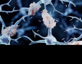 Research highlights overall brain health as key predictor of Alzheimer's risk