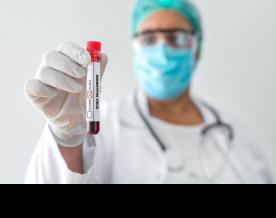 India develops indigenous Mpox detection RT-PCR kit