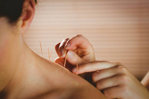 Govt considering recommendation to set up regulatory mechanism on acupuncture