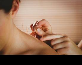 Govt considering recommendation to set up regulatory mechanism on acupuncture