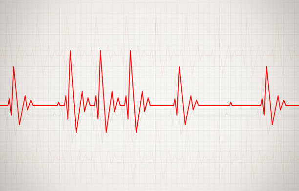 AI-model developed to predict irregular heartbeat 30 minutes before onset in new study