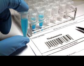 Coal India inks MoU with Fortis Healthcare to treat thalassemic children under CSR initiative