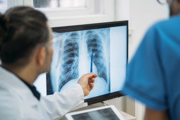 India develops indigenous hand-held X-ray for TB screening