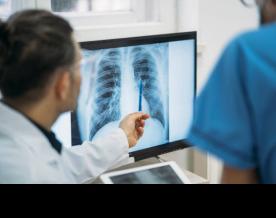 India develops indigenous hand-held X-ray for TB screening
