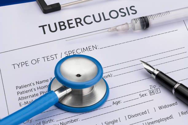 India logged highest number of TB cases in 2024: WHO report
