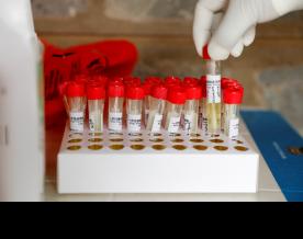 New COVID variant FU.1 in Gadchiroli, Maharashtra