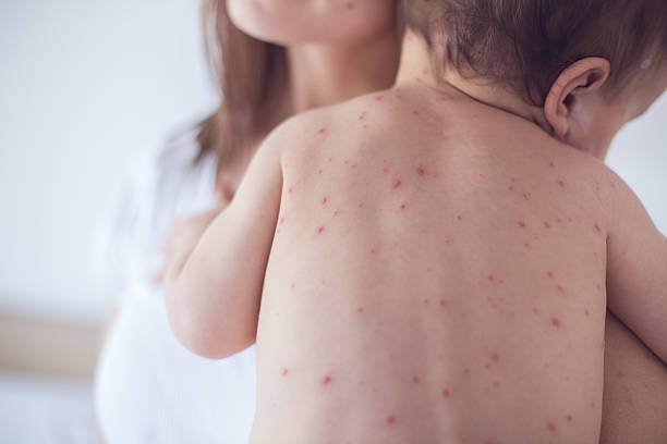 The Ministry of Health of Kyrgyzstan launches an investigation into the death of a 1-year-old child following measles vaccination