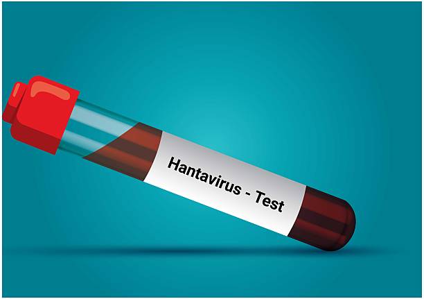 Hantavirus requires prolonged close contact for transmission unlike Covid: Soumya Swaminathan